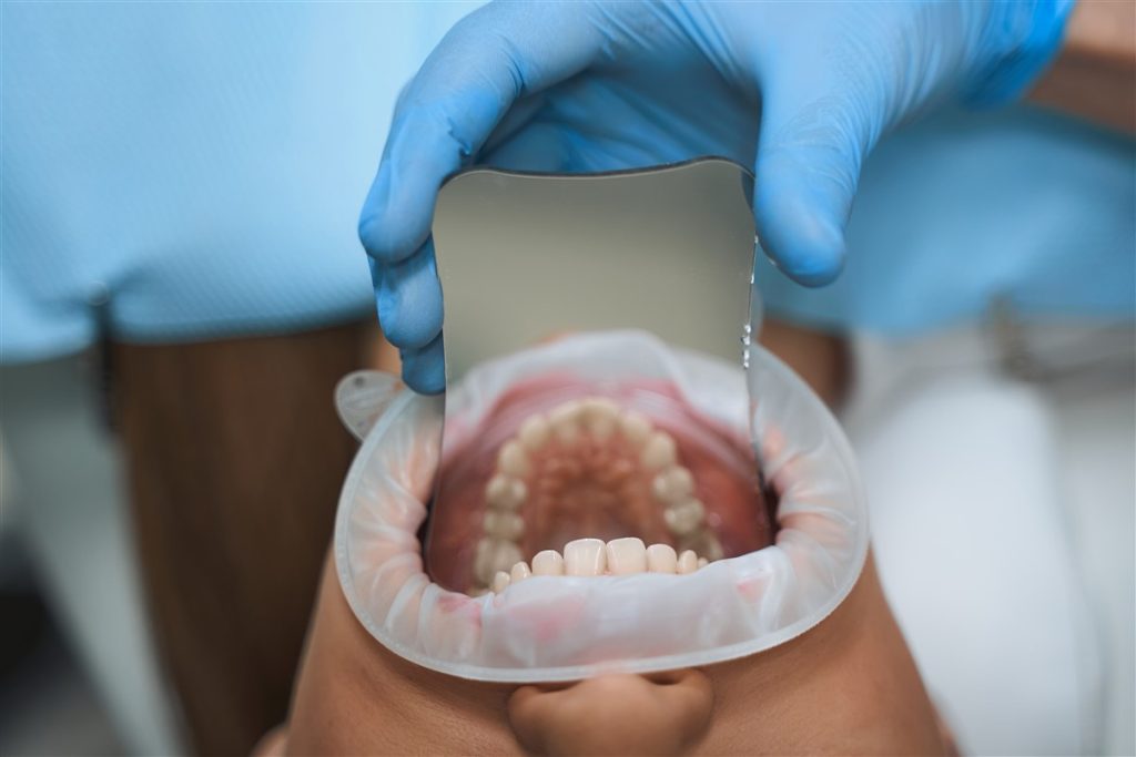 Les avantages du dentifrice médical dans la prévention des caries dentaires