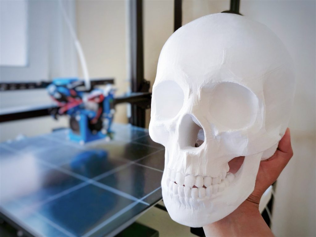 Impression 3D en médecine : comment elle sauve des vies