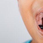 savoir-si-on-a-le-cancer-des-dents